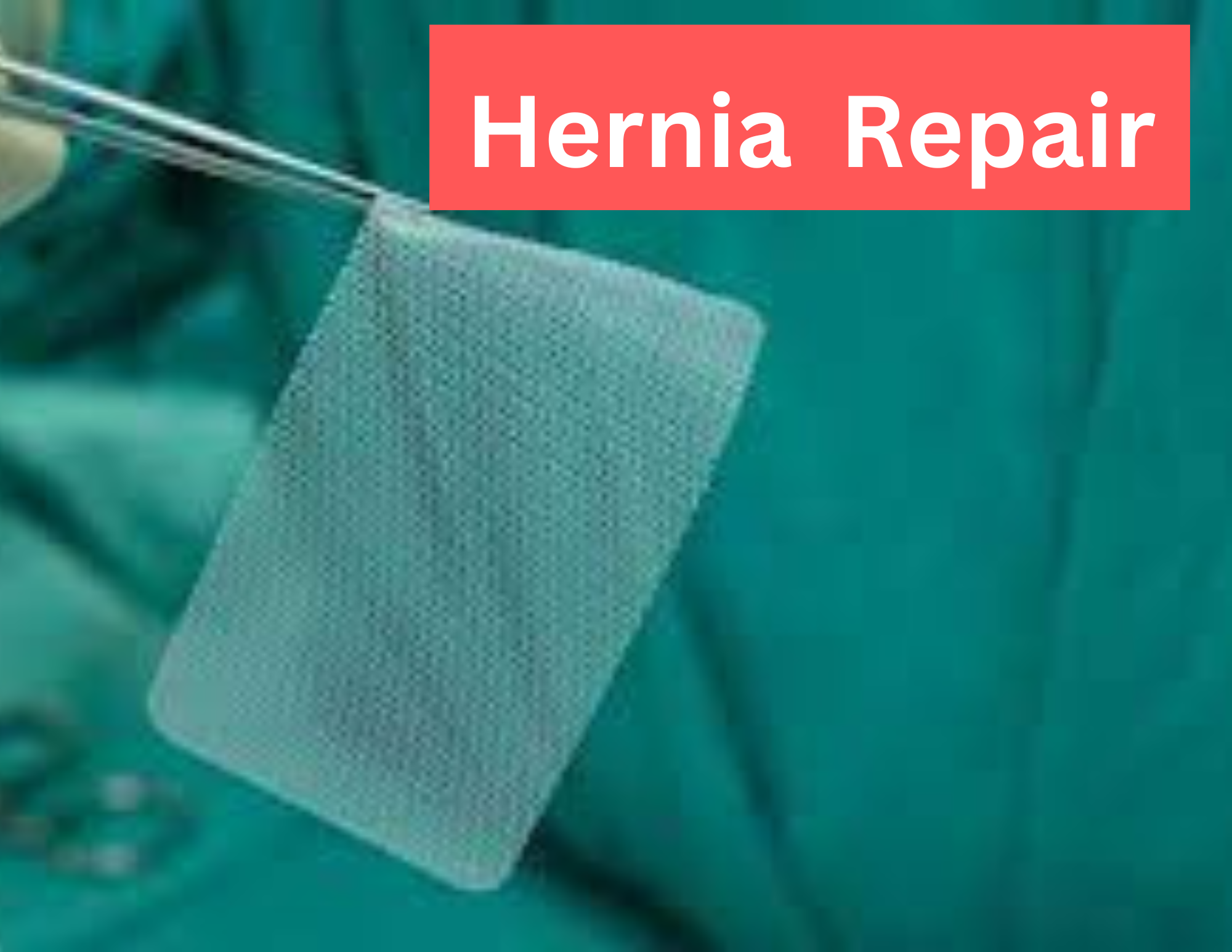 hernia