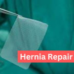 hernia