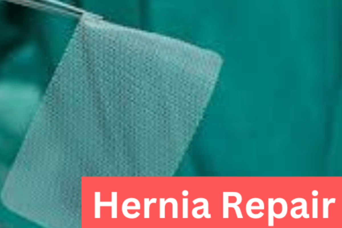 Getting Ready for Open Hernia Surgery as a Nurse: What You Need to Know